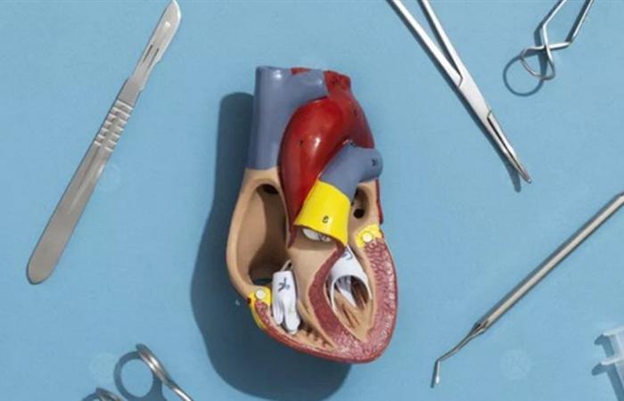 من بينها جراحة القلب المفتوح.. إجراءات طبية يخشاها الأطباء قبل المرضى